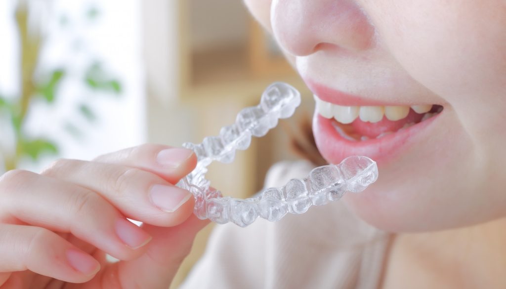 マウスピース矯正